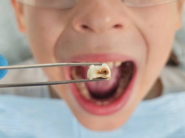 Best Pediatric Emergency Dentist in Gatlinburg, TN